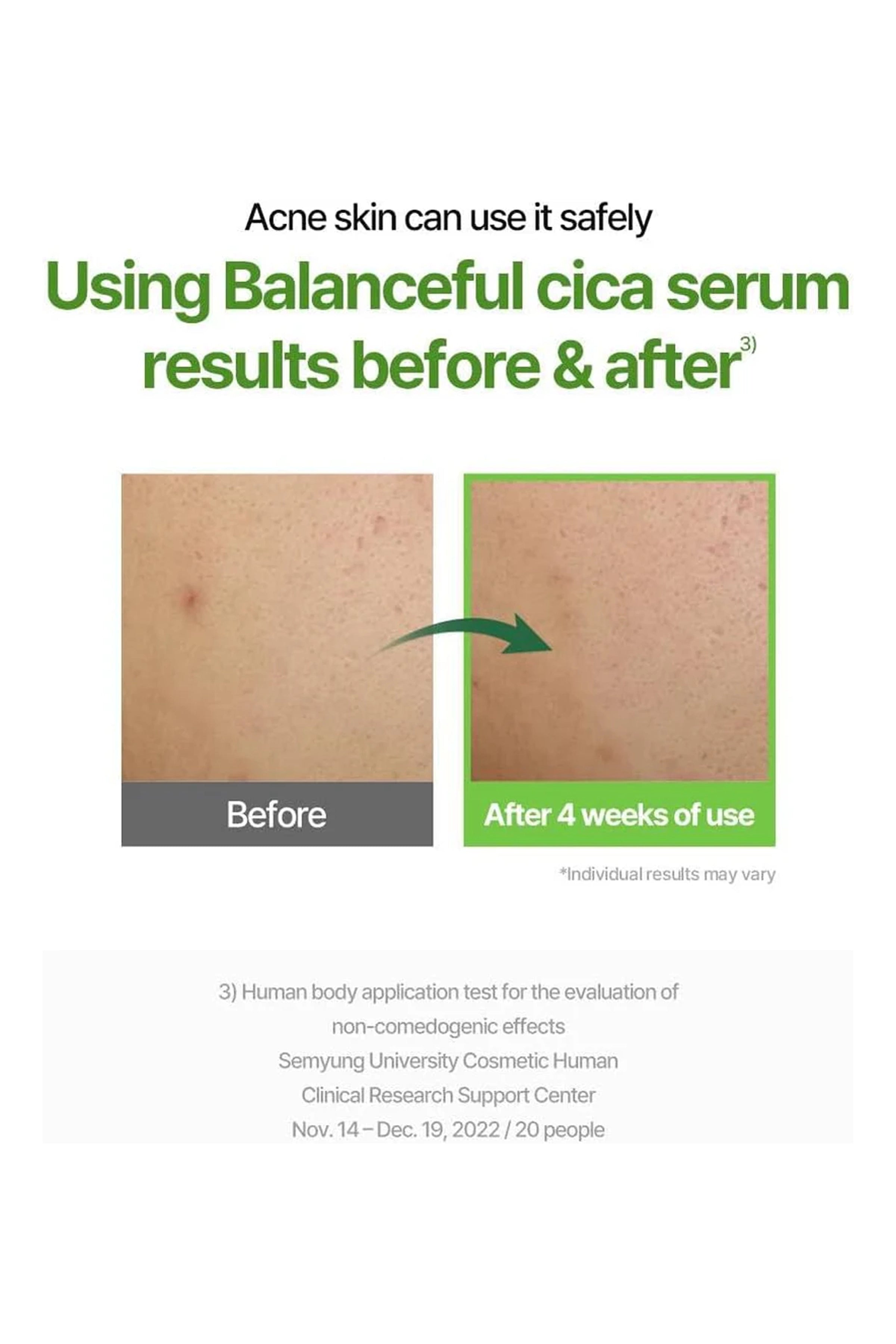 TORRIDEN BALANCEFUL SERUM 50ml