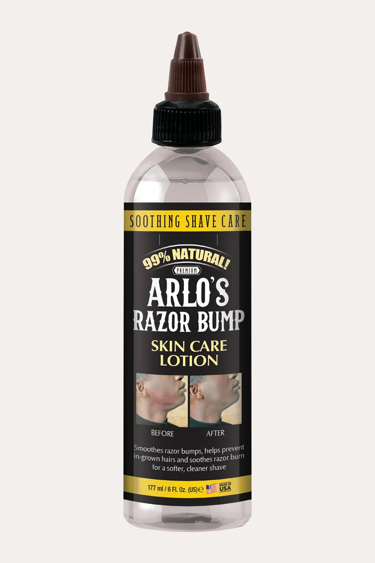 ARLO'S RAZOR BUMP SKIN CARE LOTION 6oz - BSW BEAUTY CANADA