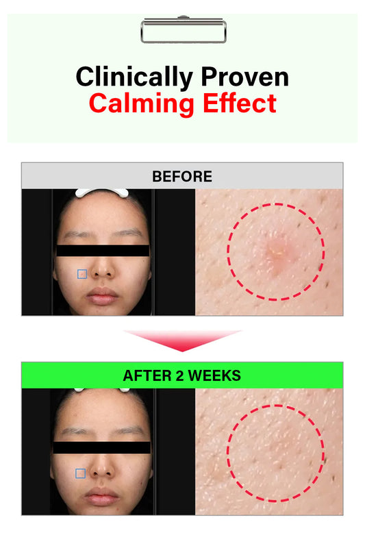 FATION NOSCA9 TROUBLE SERUM MASK - BSW BEAUTY CANADA