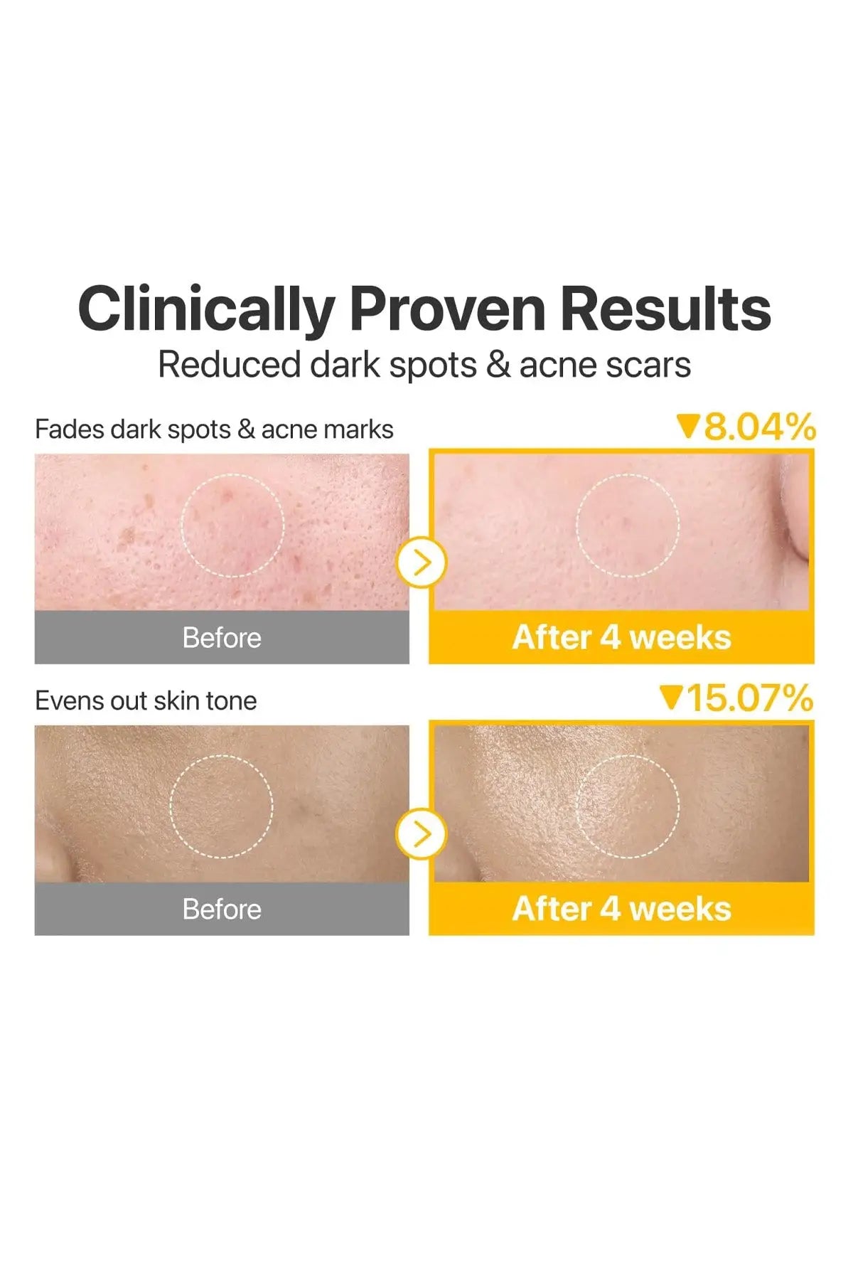 NUMBUZIN NO 5 VITAMIN NIACINAMIDE PAD NUMBUZIN