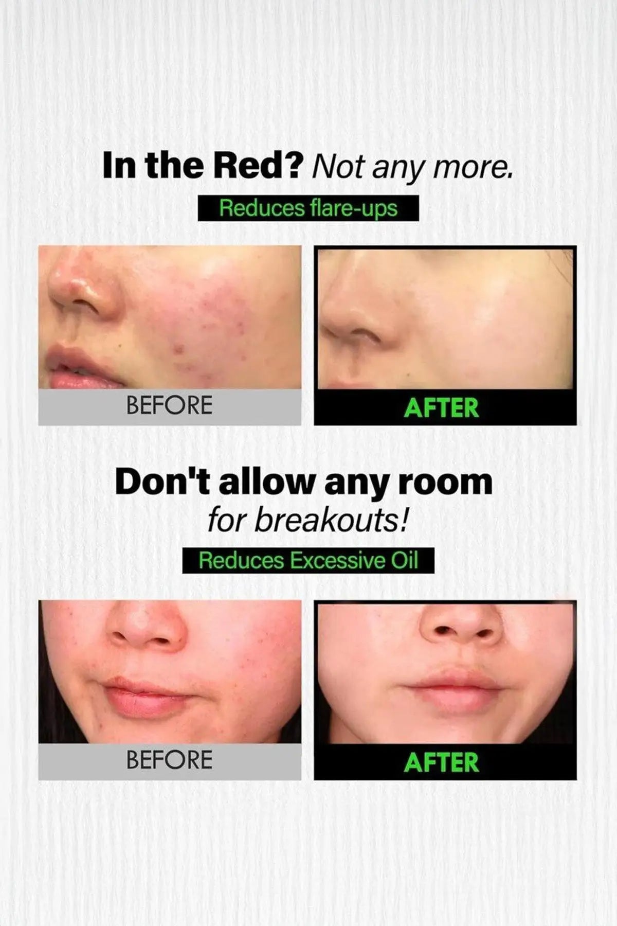 FATION NOSCA9 TROUBLE CREAM 45ml