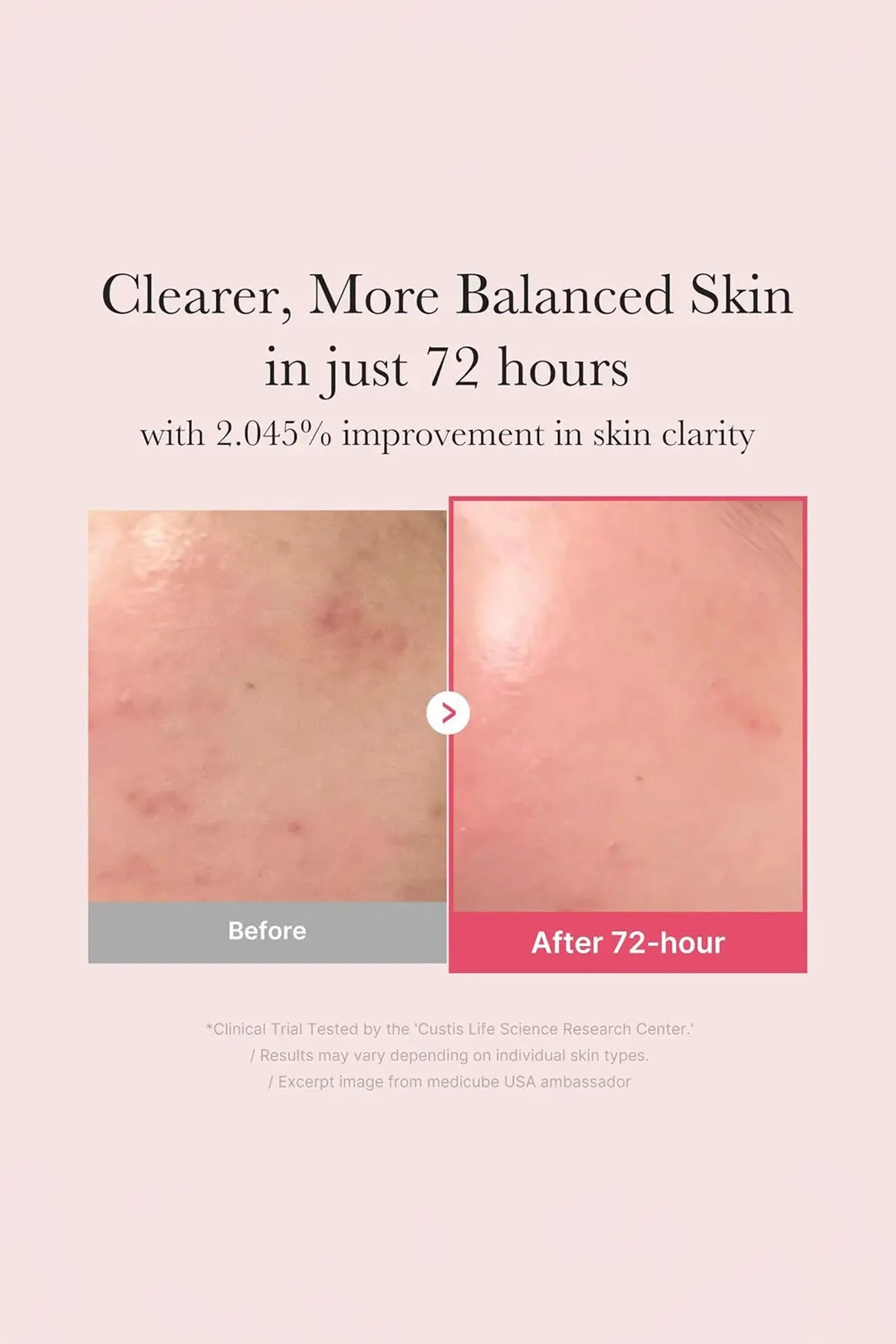 MEDICUBE TXA NIACINAMIDE 15 SERUM 30ml MEDICUBE