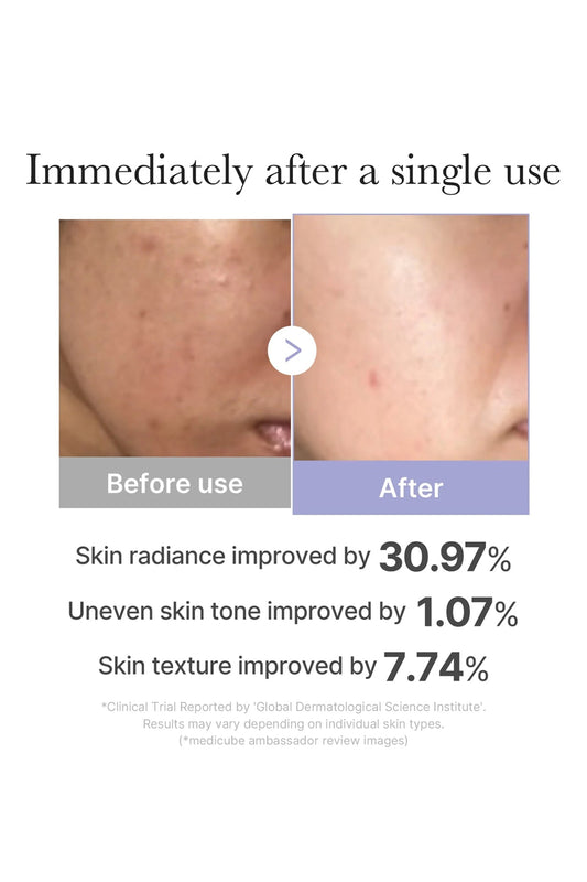 [완료] MEDICUBE AGE-R BOOSTER PRO MINI – PORTABLE LED SKIN BOOSTING DEVICE MEDICUBE