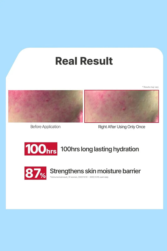 ILLIYOON CERAMIDE ATO LOTION | For Sensitive & Dry Skin ILLIYOON