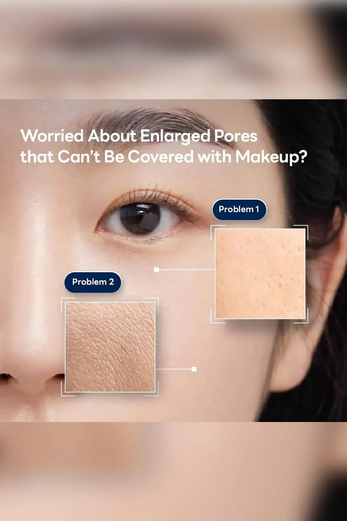 MEDIHEAL SPICULE PORE TIGHTENING SYSTEM 1