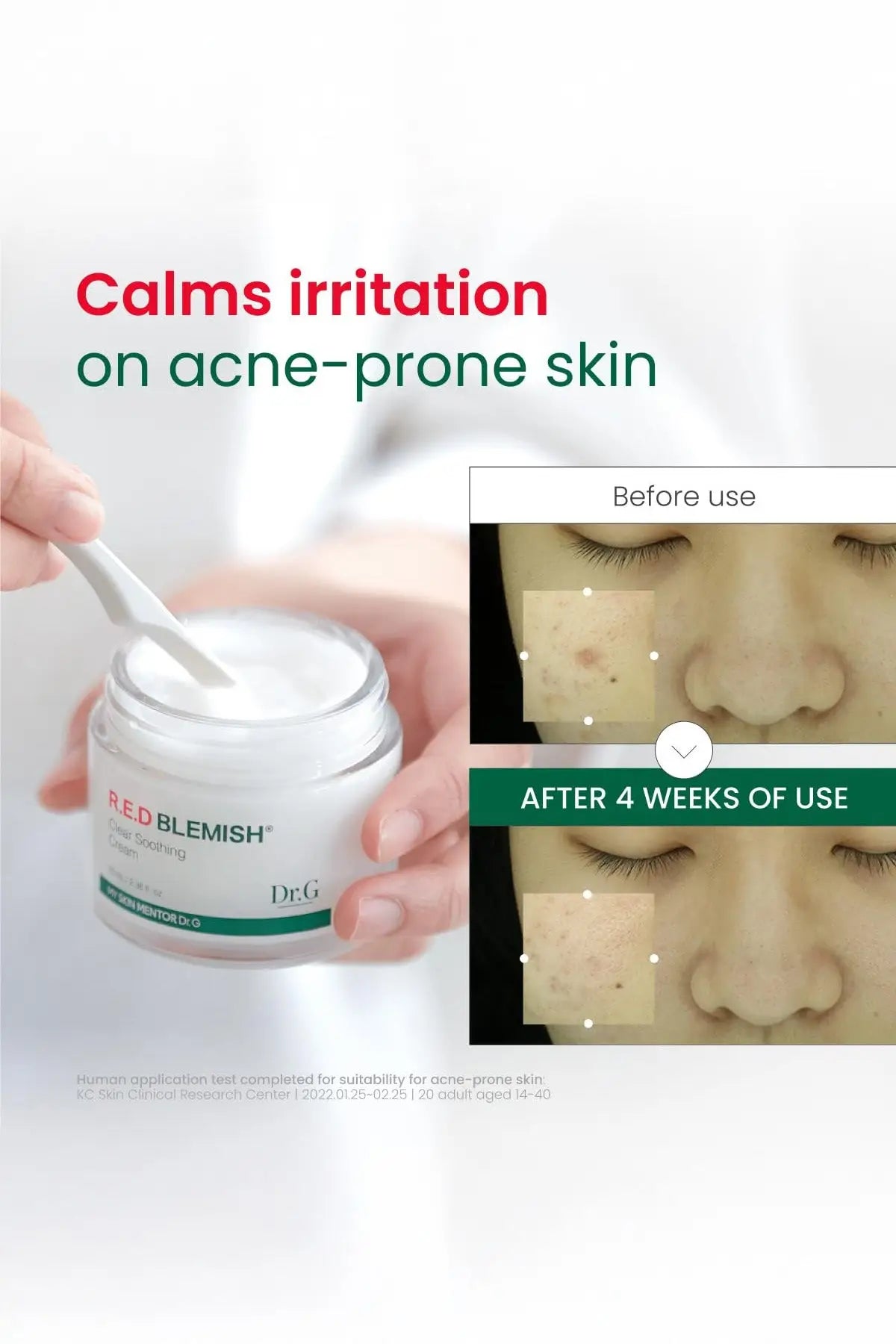 DR.G R.E.D BLEMISH CLEAR SOOTHING CREAM 70ml