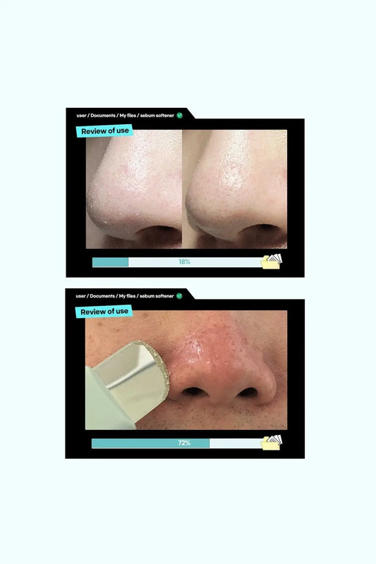 ILSO SUPER MELTING SEBUM SOFTENER SET ILSO