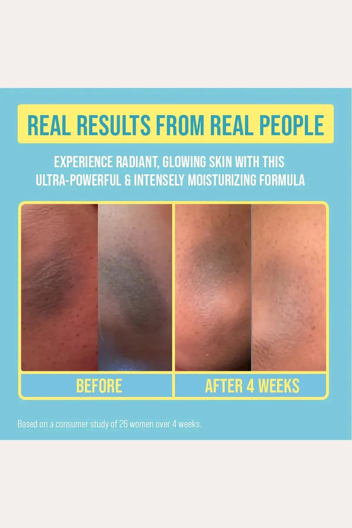 RED BY KISS GLOW UP BRIGHTENING BODY CREAM - KOJIC ACID, VITAMIN C & NIACINAMIDE - BSW BEAUTY CANADA
