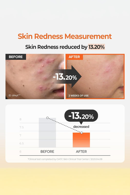 SKINFOOD CARROT CAROTENE CALMING WATER TONER PADS - BSW BEAUTY CANADA