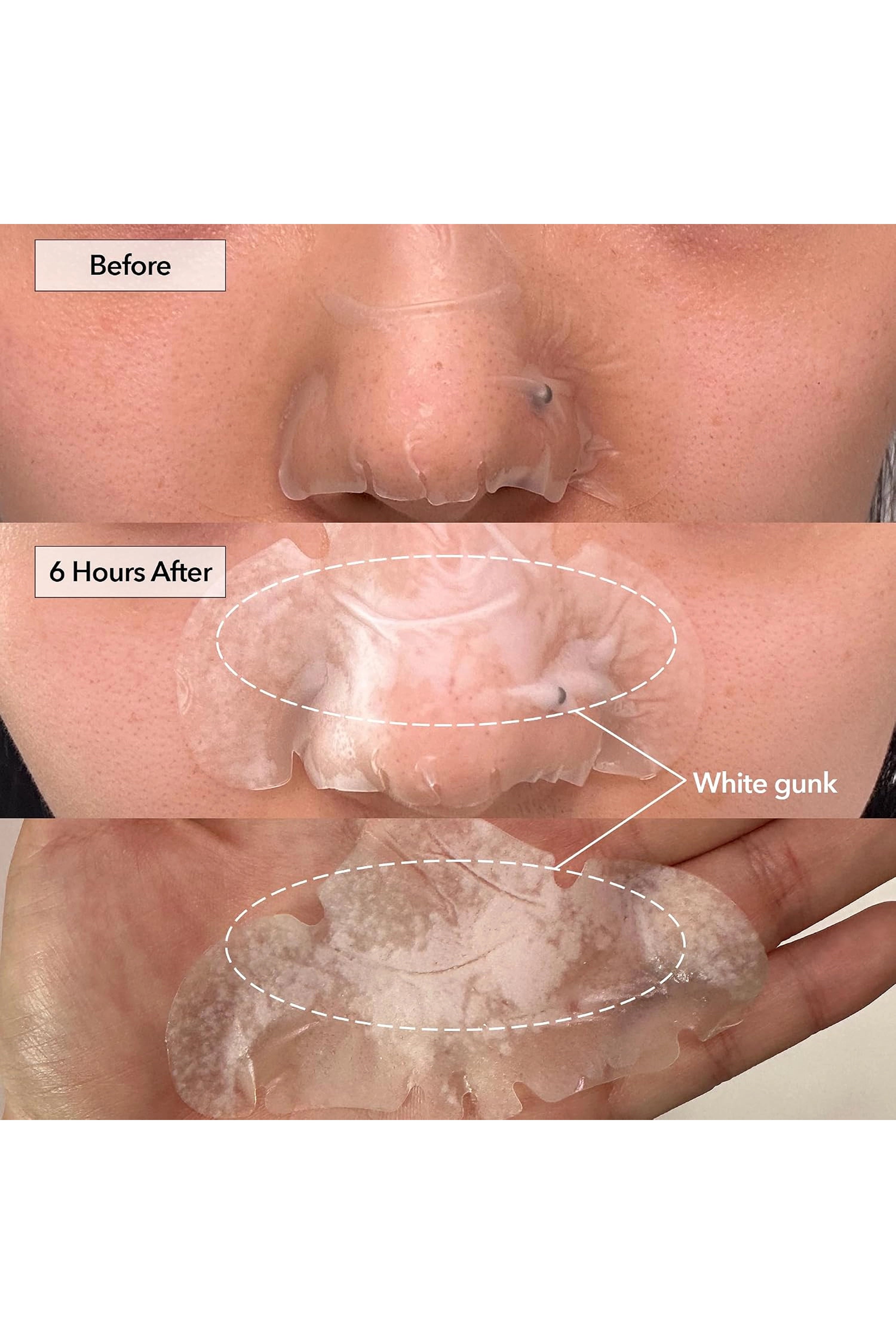 FREEGO PIMPLE & PORE SPOT PATCH
