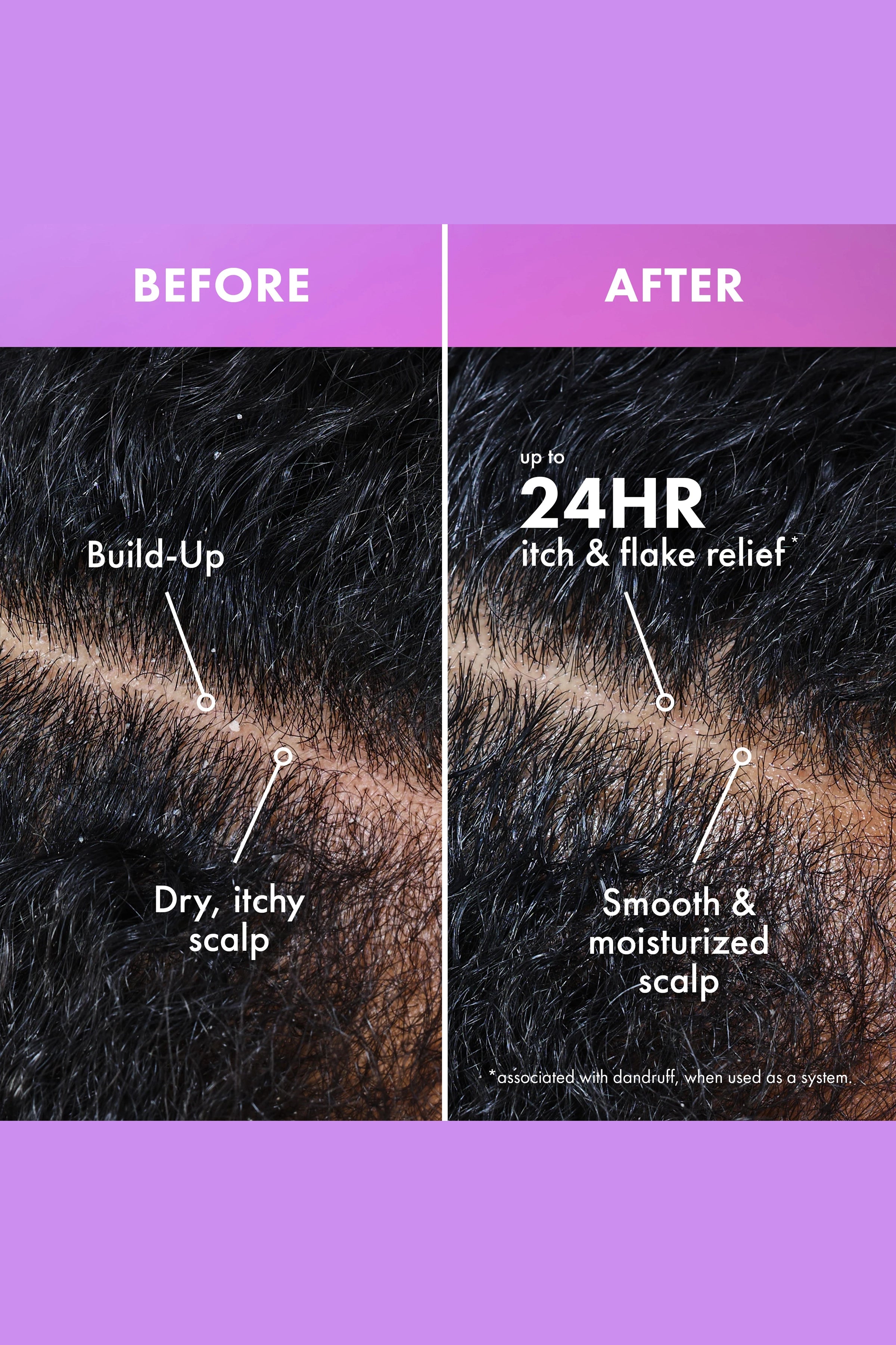 MIELLE LAVENDER & LYCHEE SCALP AND HAIR BUILD UP REMOVER