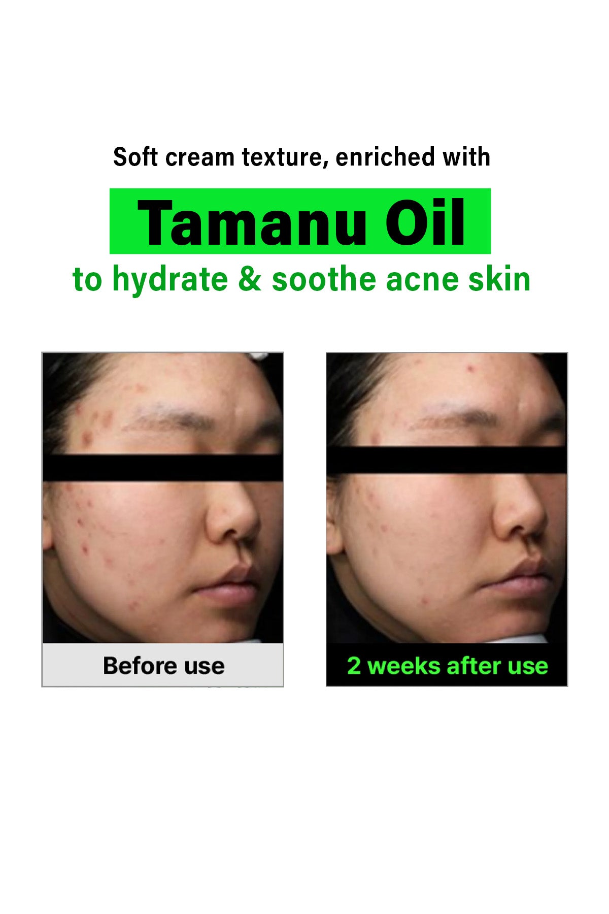 FATION NOSCA9 TROUBLE CLEANSING FOAM 150ml