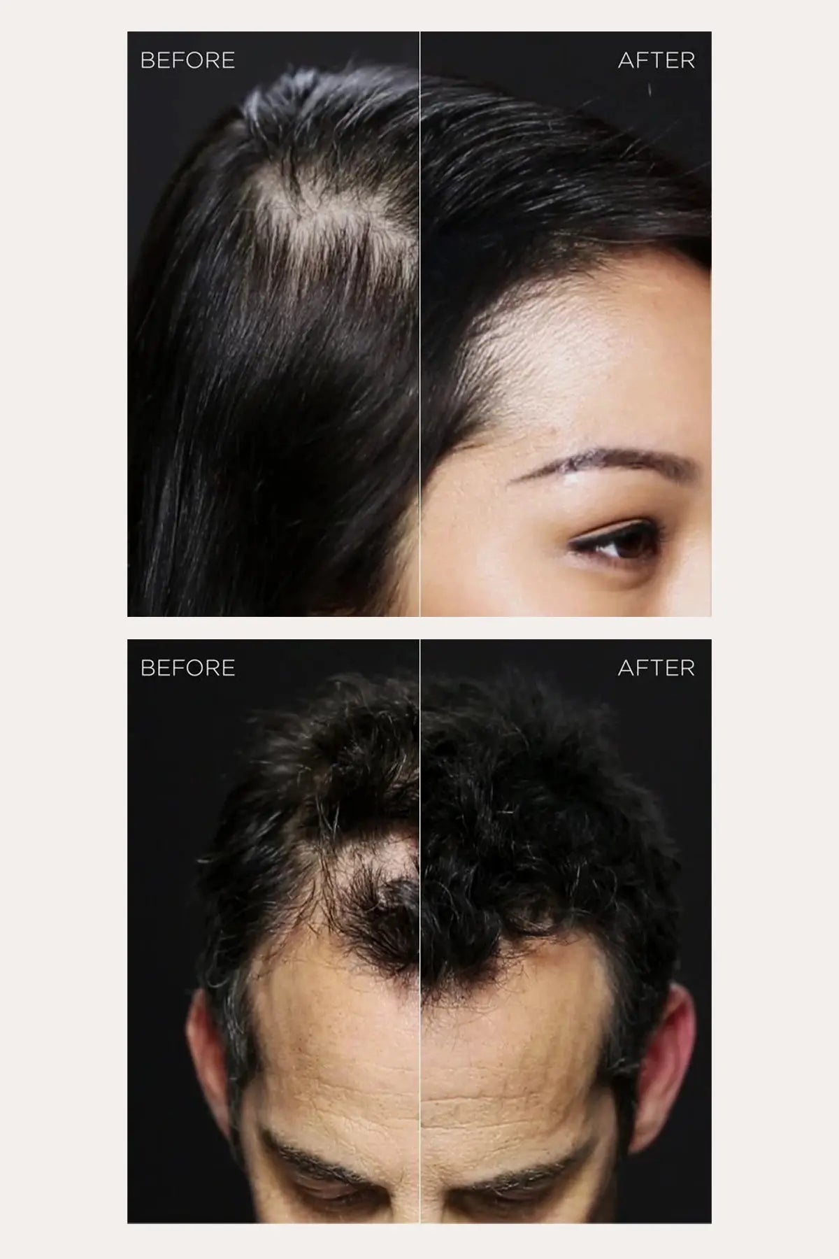 TOPPIK HAIR BUILDING FIBERS TOPPIK