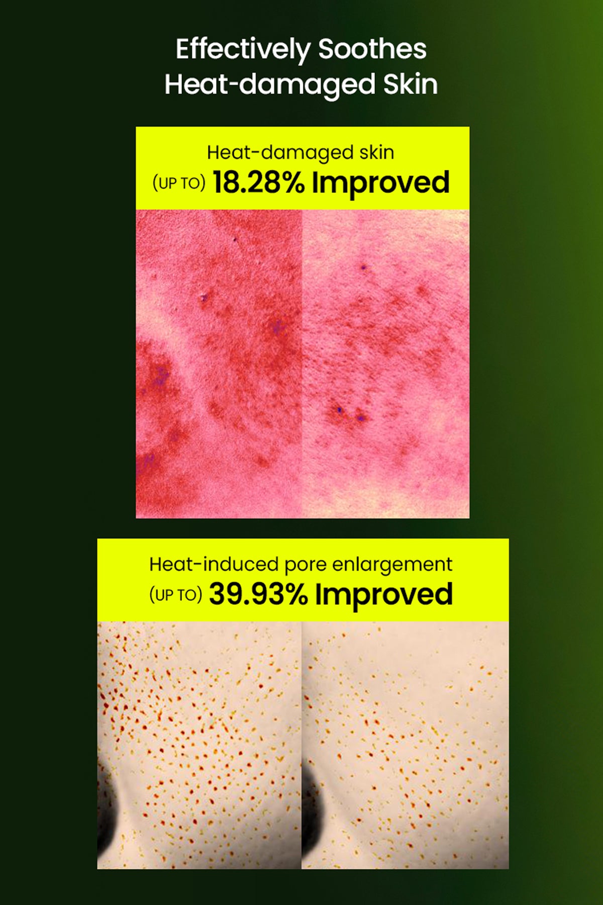 BEPLAIN MUNG BEAN PORE TIGHT | UP PEPSIDE SOOTHING CREAM