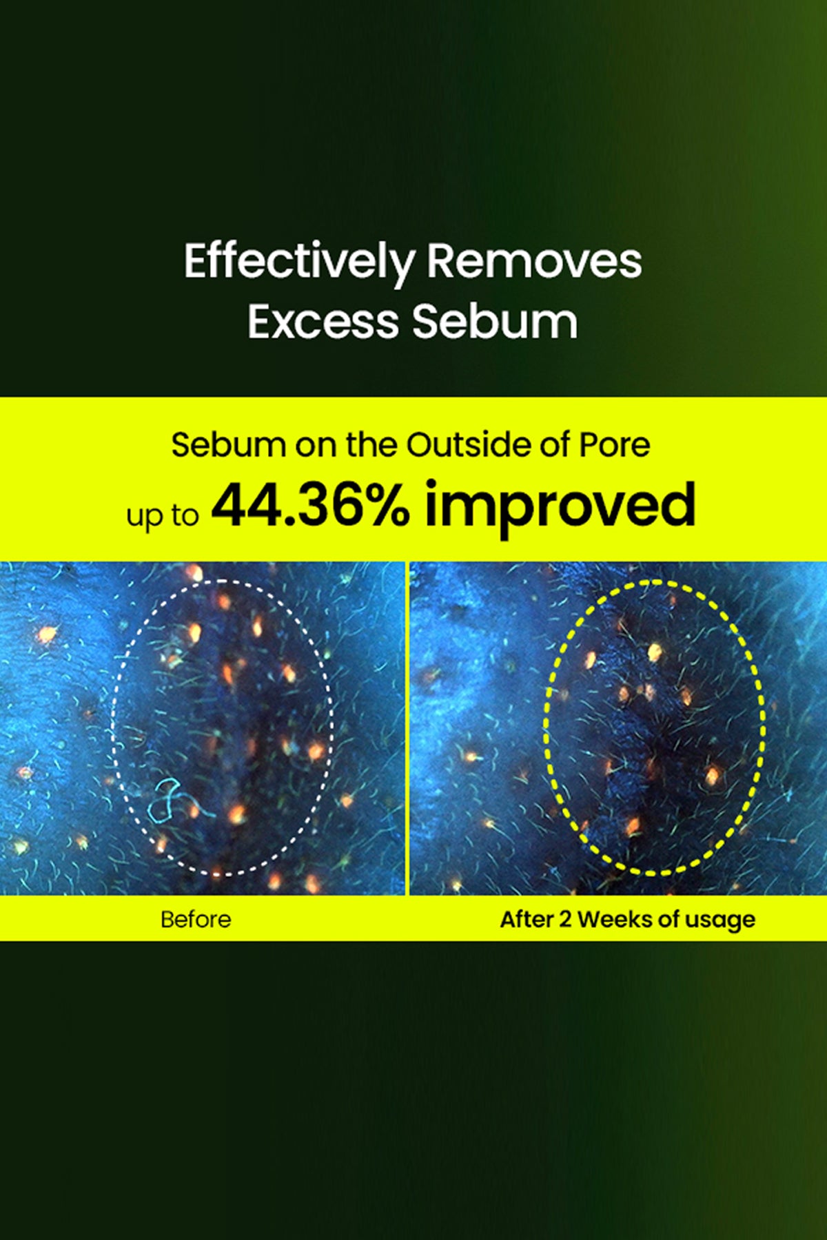 BEPLAIN MUNG BEAN PORE TIGHT | UP PEPSIDE SOOTHING CREAM