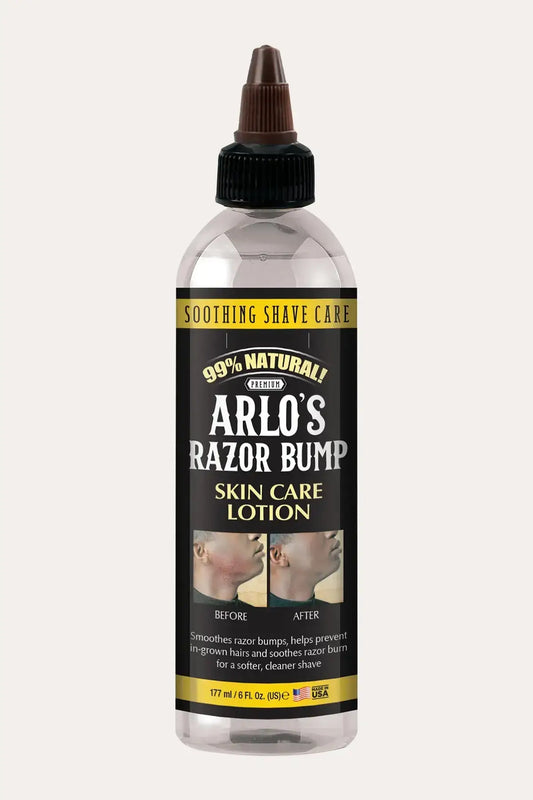 ARLO’S Razor Bump Skin Care Lotion 6 fl oz (177 ml) bottle, Aftershave Lotion for Sensitive Skin, front label view
