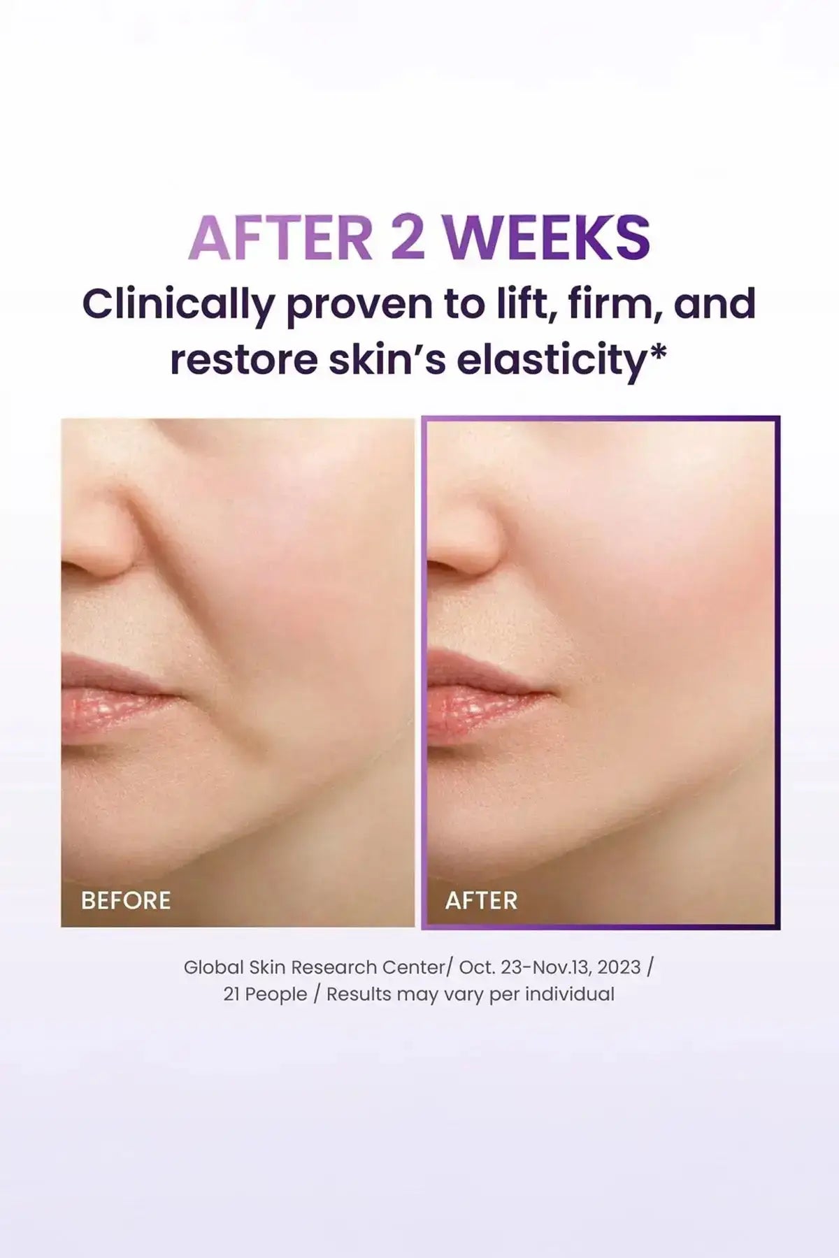 BOH Probioderm Cream Best Korean Anti Aging Cream - Before and After 2 Weeks Results, Clinically Proven to Lift Firm and Restore Skin's Elasticity, Global Skin Research Center Study Oct 23-Nov 13 2023