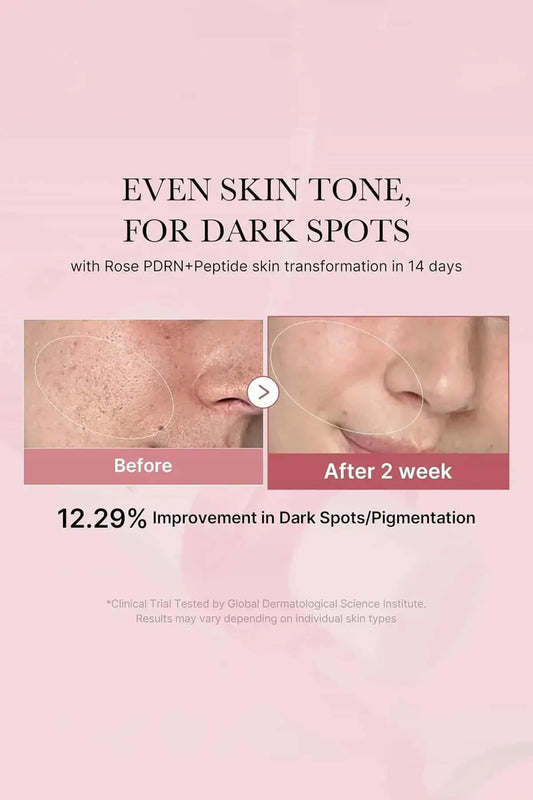 Before and after results showing 12.29% improvement in dark spots and pigmentation after 2 weeks of use.