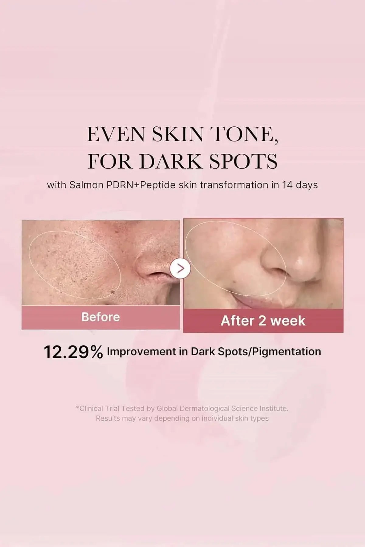Before and after results showing a 12.29% improvement in dark spots and pigmentation after 14 days.