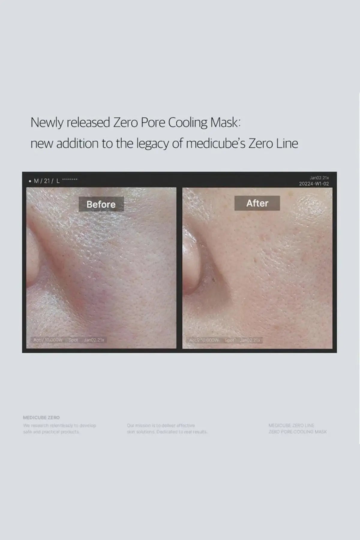 Before and after close-up showing reduced pore visibility after using the pore tightening mask.