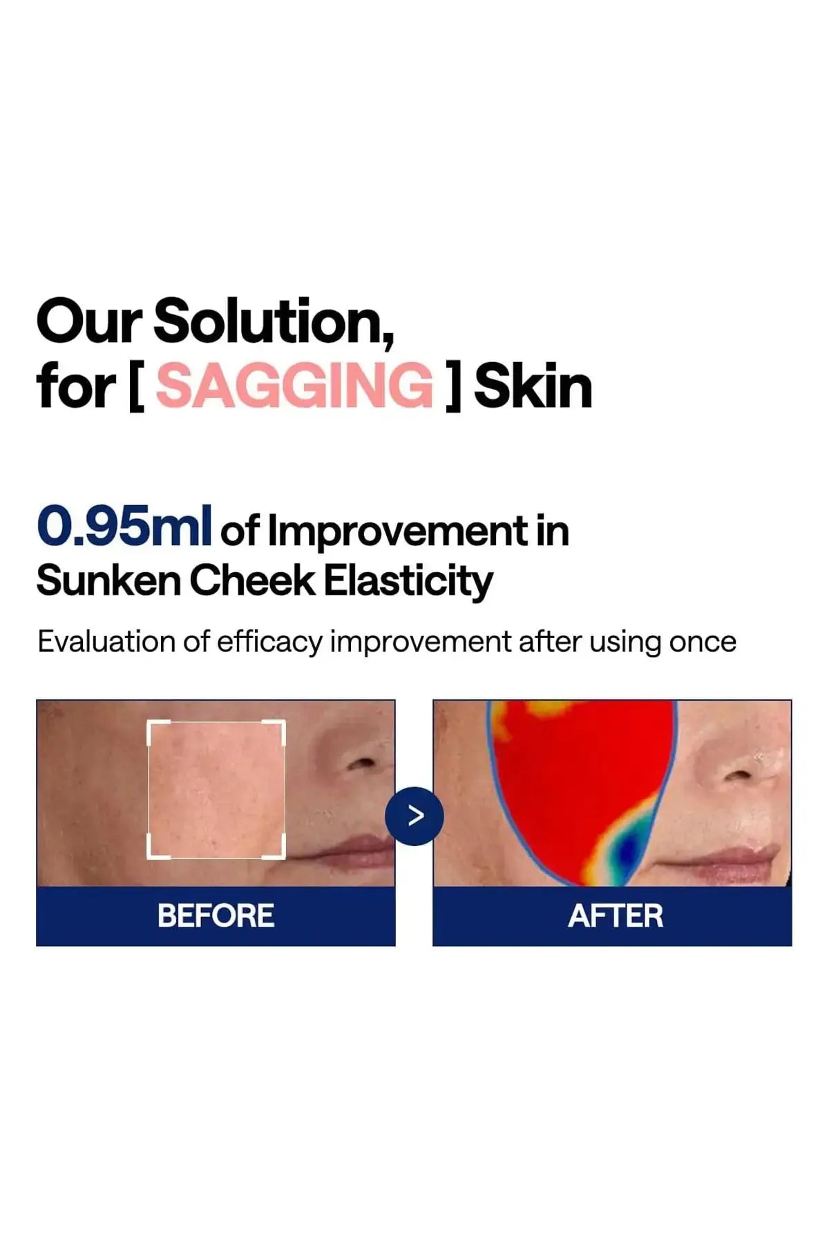 Before and after results showing improvement in sunken cheek elasticity after using this Daily Collagen Mask.