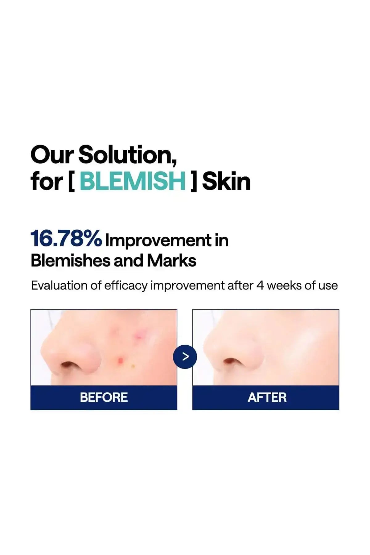 Before and after results showing significant blemish and skin tone improvement after 2 weeks of using the Madecassoside infused toner pads.